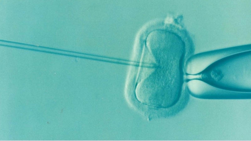 IN VITRO FERTILISATION: During IVF, an egg is removed from the woman's ovaries and fertilised with sperm in a laboratory