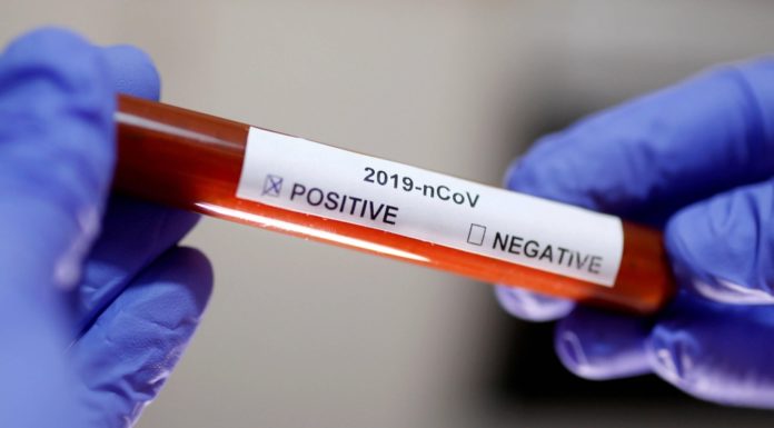 “Fighting the fire blindfolded” – UK’s virus testing falls short